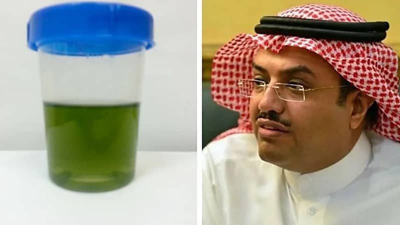 النمر يكشف عن سبب تغير لون البول إلى الأخضر