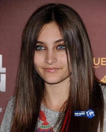 استأجرتا من يضربهما للحصول على  إجازة مرضية