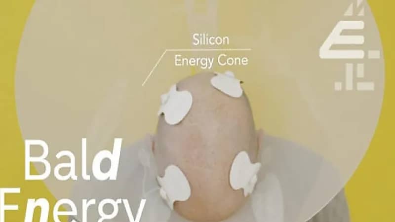 حقيقة الأخبار المتداولة بشأن توليد الكهرباء من " صلعة الرجال"