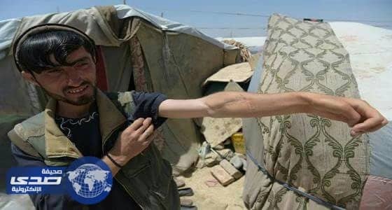 إصابة ثمانية مدنيين أفغان في غارة جوية