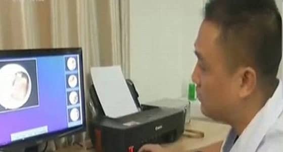 بالفيديو.. العثور على 26 صرصورًا داخل أذن رجل