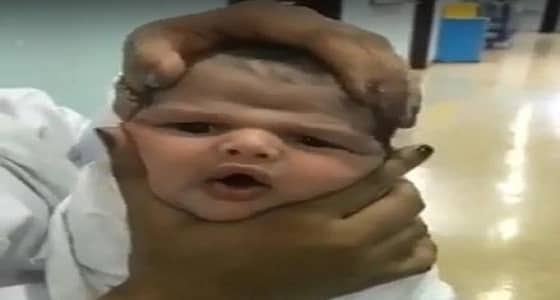 محامِ يكشف عقوبة ممرضات واقعة " رضيع الطائف "