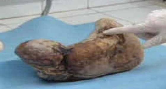 امرأة هندية تكتشف بقايا ابنها المتحجر من 15 عامًا