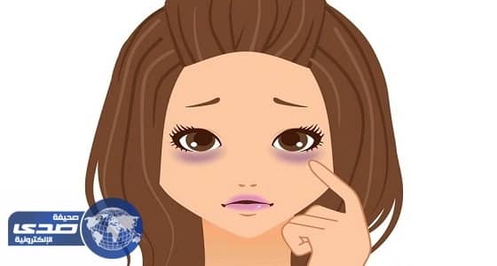 5 أمراض تكشفها الهالات السوداء تحت عينيك