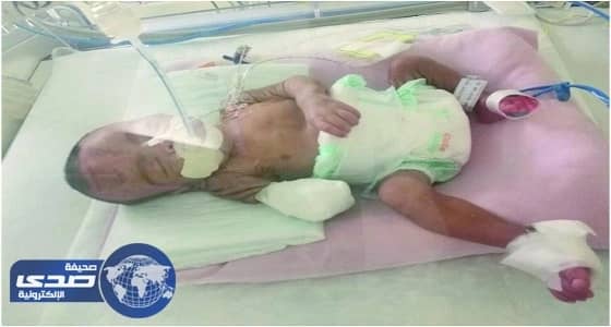 أسرة " رضيع أبو عريش " تتخذ خطوة رسمية لمقاضاة " الصحة "