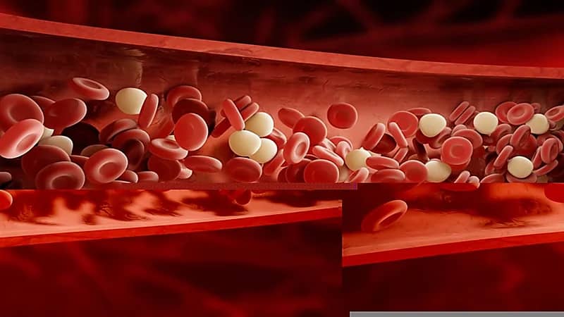 أسباب اضطراب فرط شحميات الدم