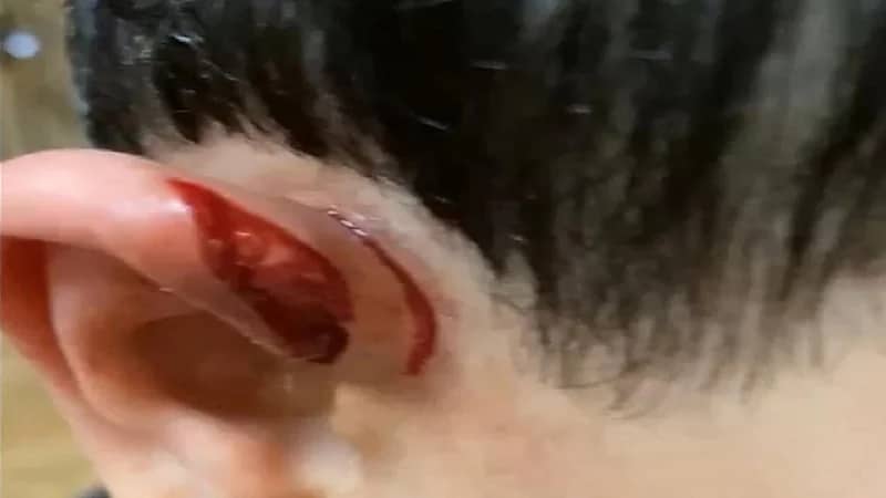 ذئب يهاجم طفلًا بالأفلاج