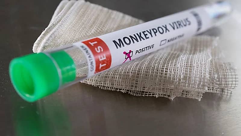 الصحة العالمية: 98% من المصابين بجدري القردة "رجال مثليين"