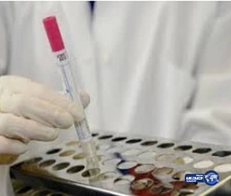 شركة أمريكية: لقاح "كورونا" الخاص بالإبل آمن وفعال للبشر