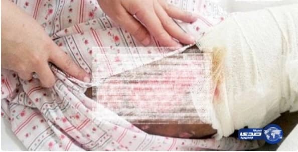 إيقاف مواطن وزوجته الثانية لتورطهما في تعذيب الزوجة الأولى 