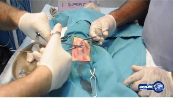 كسر بقدم مواطنة ينتهي بفشل كلوي وتسمم بالدم بسبب خطأ طبي بجدة