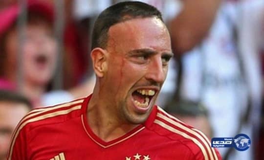 بلاتيني يهدد بايقاف فرانك ريبيري عن اللعب