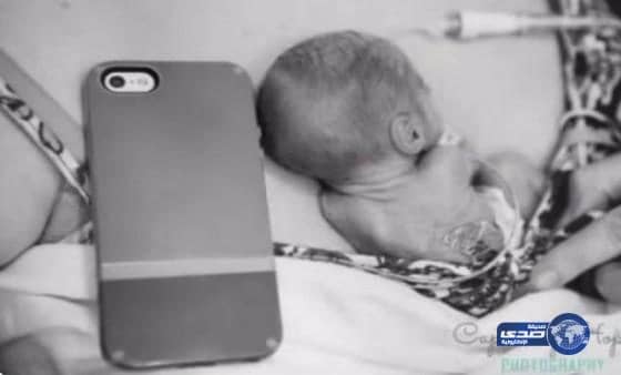 بالفيديو:ولادة الطفل الأصغر حجماً في العالم بحجم هاتف محمول