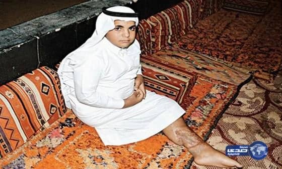 نقل دم ملوث يتسبب في إصابة طفل "بالإيدز"