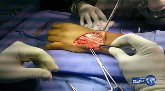 مستشفى النبهانية ينجح في إعادة الحركة لأصابع يد عشريني