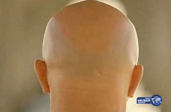 زوجة شابة تطلب الخلع بعد 48 ساعة من الزواج:" زوجي أصلع"