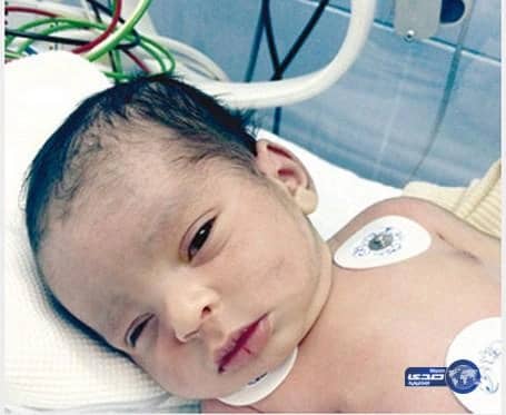 مقيم يتهم مستشفى بكسر جمجمة ابنه بحفر الباطن