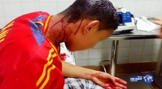 مشاجرة أمام مطعم في تربة تدخل شاباً المستشفى