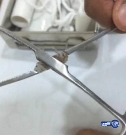 مقطع فديو متداول يحكي الوضع ( المزري ) في مستشفى رنيه 