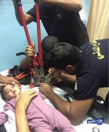 مدني المدينة يستخرج يد طفل محتجزه داخل صافرة قدر الضغط