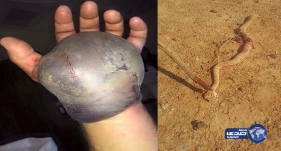 بالفيديو والصور .. الحية "ٲم جنيب" تقفز على رجل ٲثناء تصويره لها