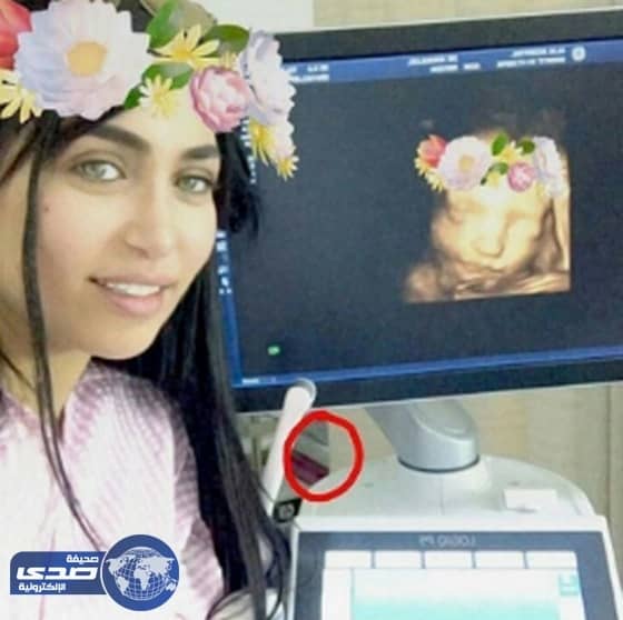 سيلفي الدكتوره خلود...