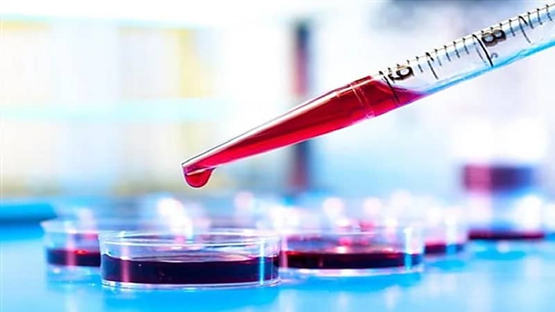 طريقة مبتكرة للكشف عن الجلطات ومرض السكري من خلال الجوال.. فيديو