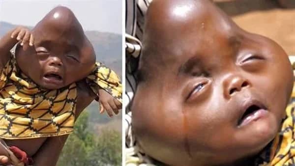 سيدة تنجب مولودا استثنائيا بـ رأس هرمي ووالده يتركه