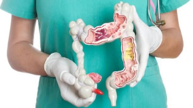 هل يمكن حدوث نزيف بعد استئصال لحمية القولون؟.. الذيابي يُجيب