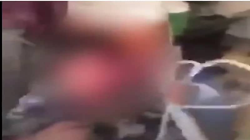 بالفيديو.. طفل "مدمى" يتعرض لتعذيب وحشي على يد والده : أقتلني "يابابا"