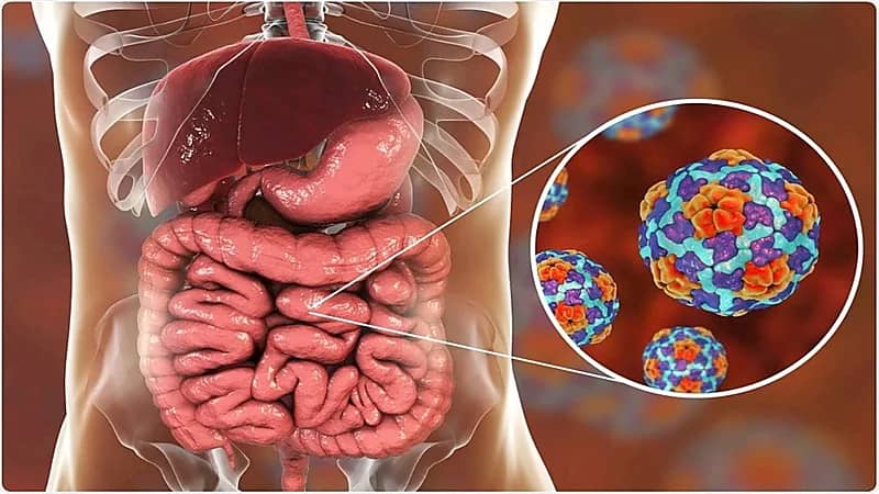 الكشف عن أعراض مرض السيلياك والفئات الأكثر عرضة للإصابة