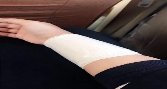 تعليم بيشة يحقق في اعتداء قائدة روضة على معلمة