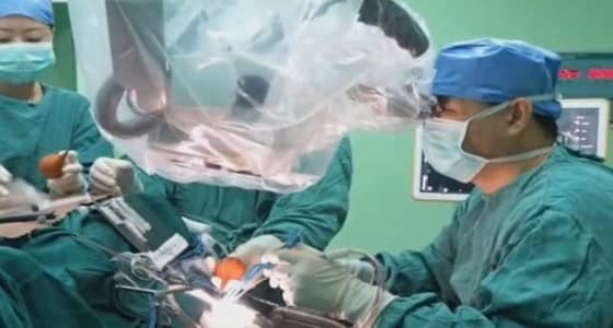 بالصور.. دودة تأكل دماغ صيني لـ15 عامًا بسبب " الحلزون المقلي "