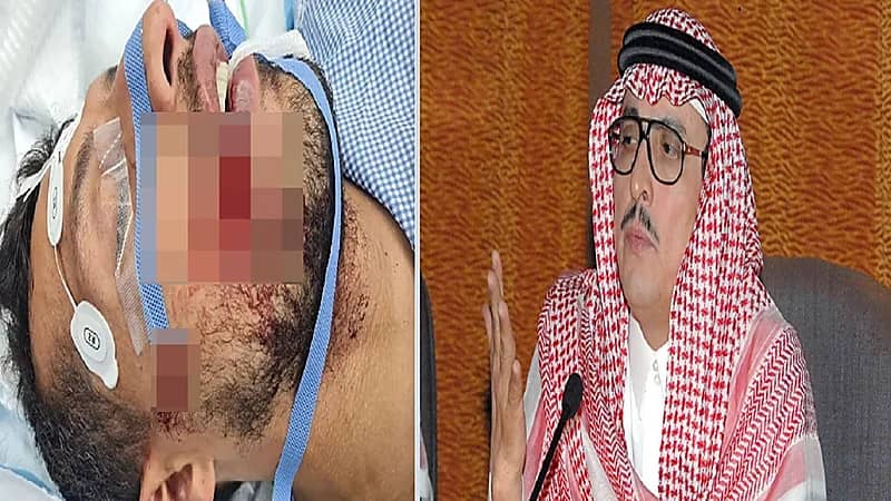 الدويش عن إصابة طارق حامد: هل تستحق الكرة مثل هذه الصورة؟