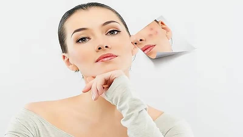 علاجات طبيعية للتخلص من البثور في البشرة