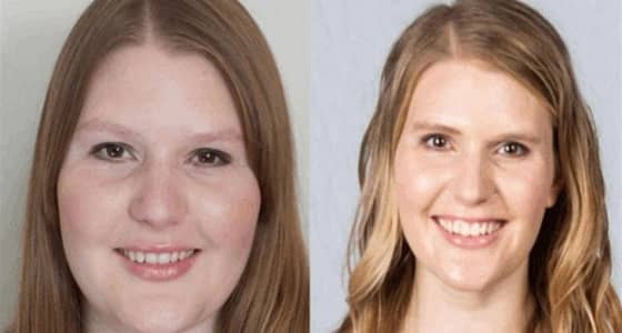 بالصور.. فتاة تتغلب على زيادة الوزن بفقدان 50 كيلو بطرق سهلة