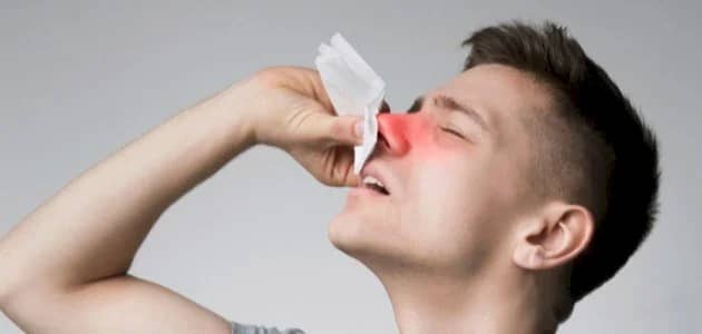 إسعافات أولية يجب مراعاتها لإنقاذ المصاب نزيف الأنف