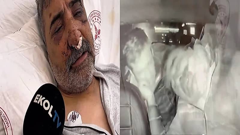 سائق تركي يتعرض للضرب والعض من ملاكم بريطاني.. فيديو