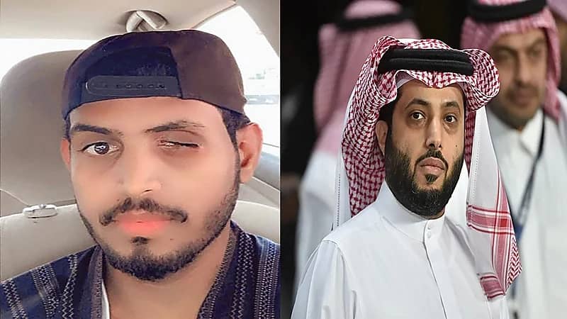 آل الشيخ يتفاعل مع حالة مواطن فقد عينه وعمله