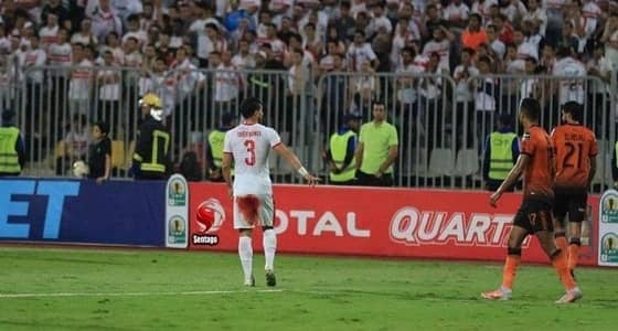 نجم الزمالك يتحدى النزيف ويصر على استكمال نهائي الكونفدرالية