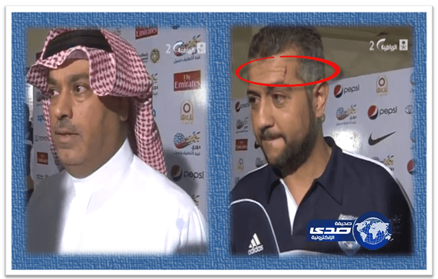 لاعب إتحادي يعتدي على مساعد مدرب النهضة ولاعب نهضاوي