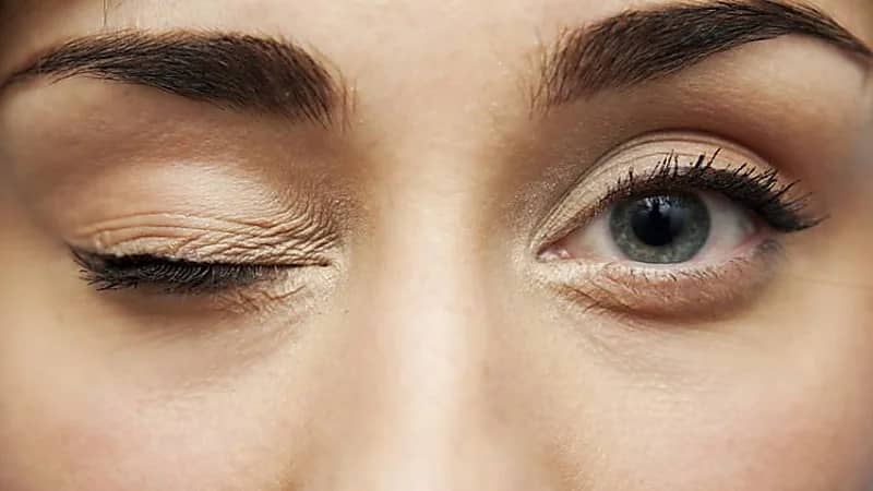 النمر: رفة العين ليست خطيرة ولا تحتاج علاج لدى الغالبية