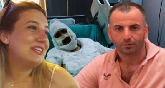 تركي يحاول قتل زوجته السابقة بطريقة مروعة