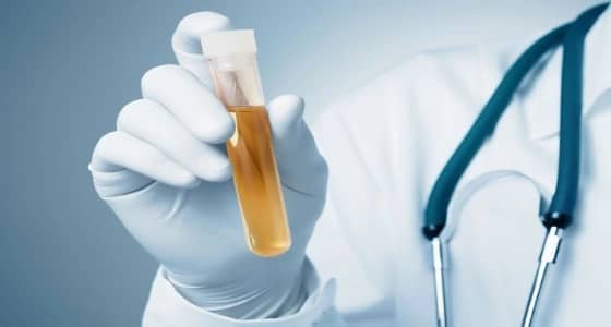 حالة مرضية غريبة لامرأة تتبول «كحول»