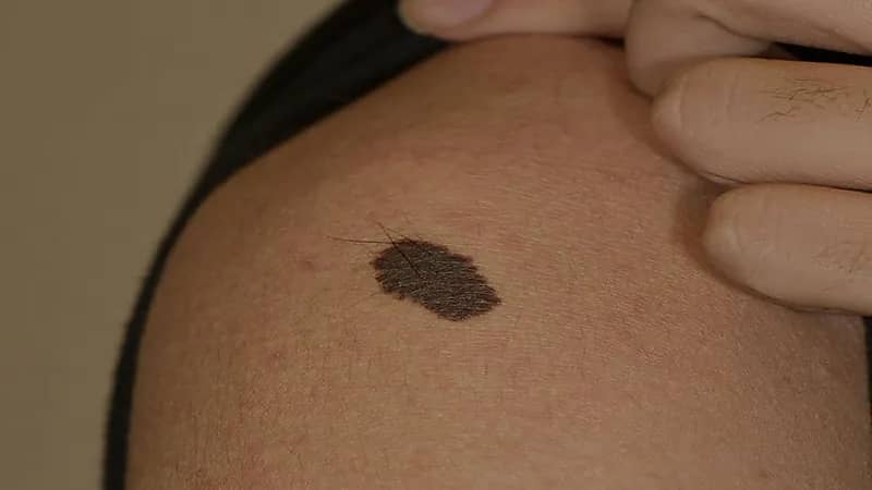 امرأة تكتشف خيانة زوجها مع صديقتها بسبب "وحمة"