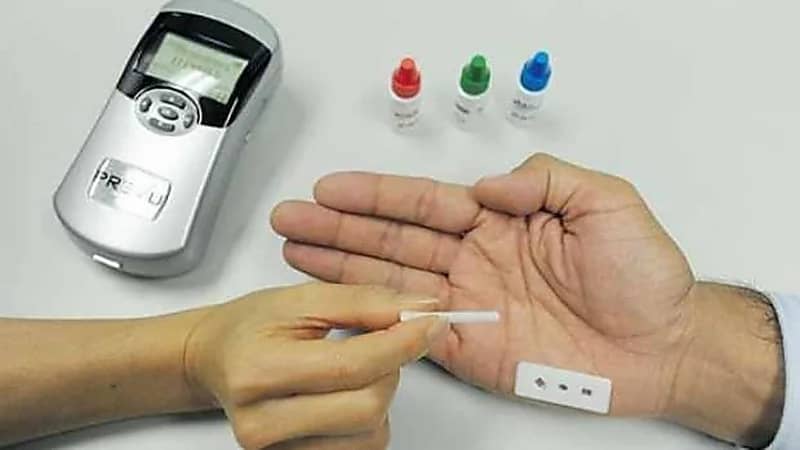 علامات تشير إلى ارتفاع الكوليسترول الضار في الجسم