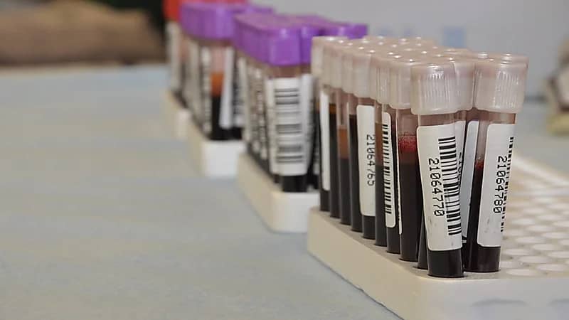 صحة الشرقية تختتم الحملة التطوعية " دمي لضيوف الرحمن"