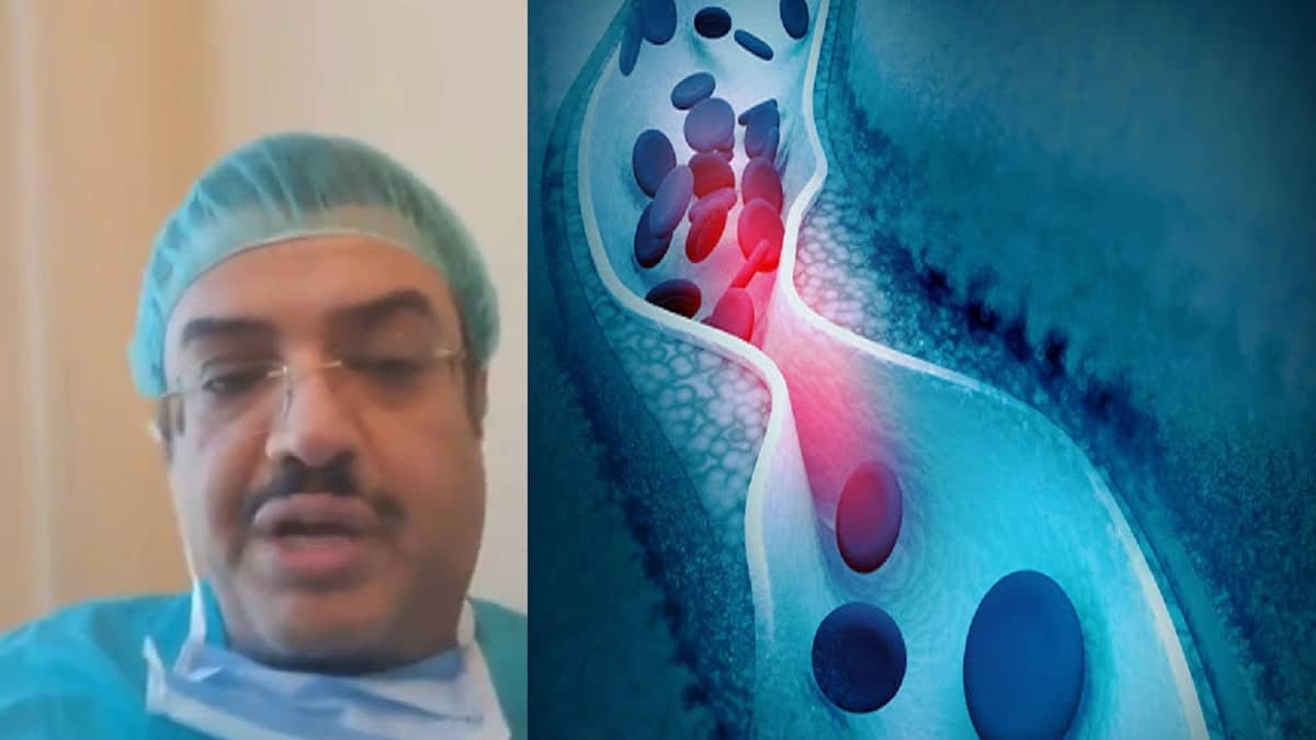 خالد النمر: لا تُهمل ارتفاع الكوليسترول فقد يتسبب في جلطة (فيديو)