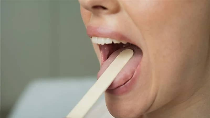 نسيج اللسان يكشف عن نقص فيتامين مهم