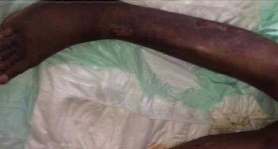 بعد تعرض خادمة مغربية للتعذيب على يد سيدتها .. غضب يجتاج مواقع التواصل